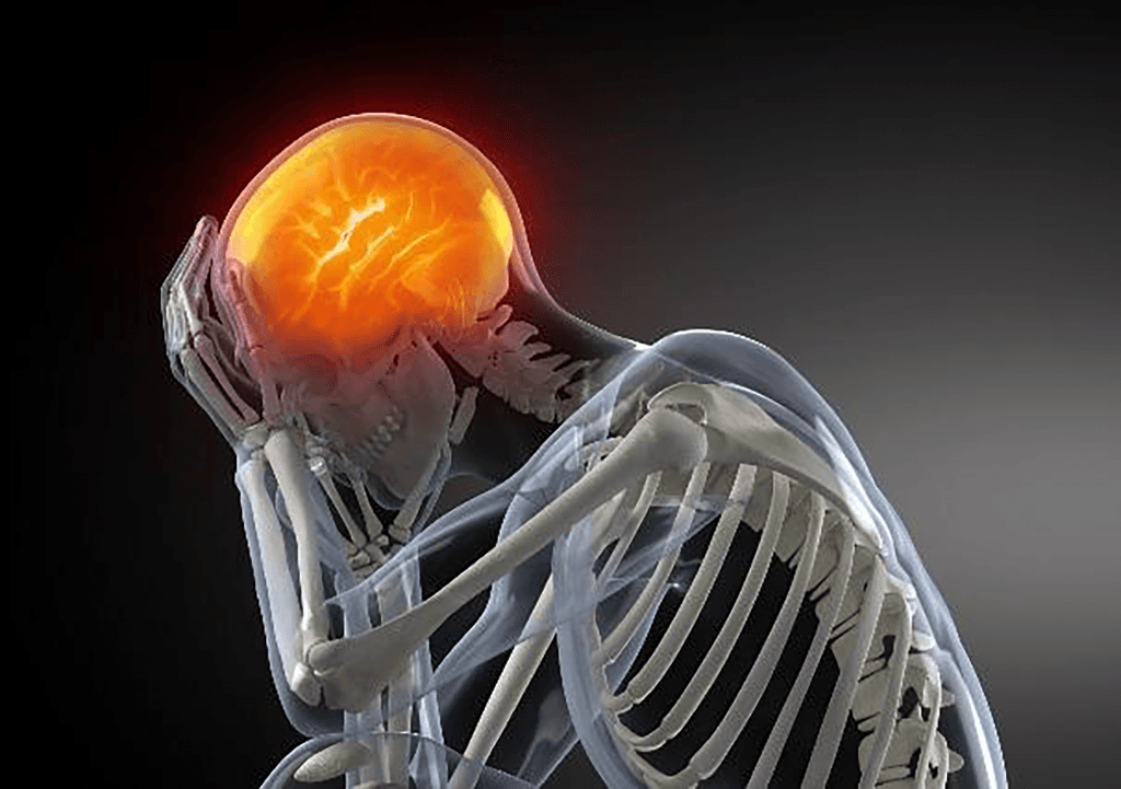 Concussion Management 